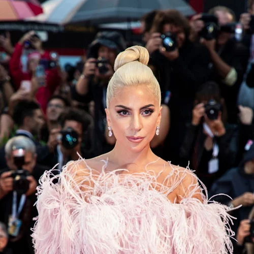 Lady Gaga | Η πλαστική επέμβαση που της ζήτησαν να κάνει στην αρχή της καριέρας της