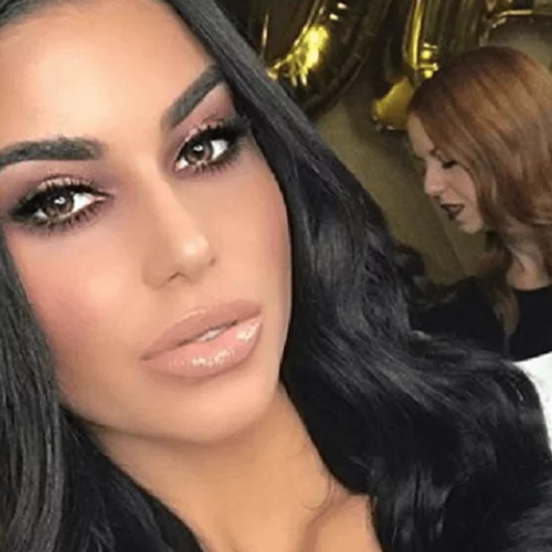 Η Ιωάννα Μπέλλα αποφάσισε να αφαιρέσει το υαλουρονικό από τα χείλη της | Δες πλάνα