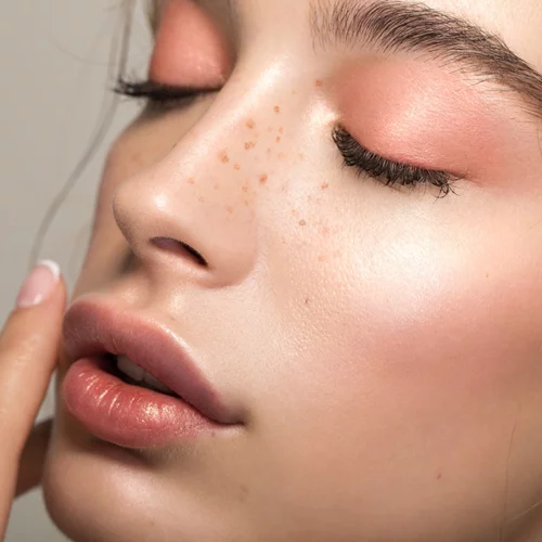 Μεσοθεραπεία | Μύθοι, αλήθειες και όσα πρέπει να ξέρεις