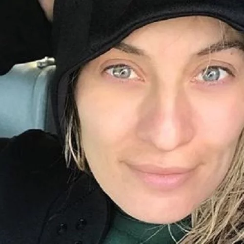 Ελεονώρα Μελέτη | Δείχνει τις μελανιές στο σώμα της και περνά ένα σημαντικό μήνυμα