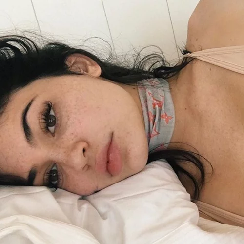 Πώς ήταν η επιδερμίδα της Kylie Jenner πριν 3 χρόνια και πώς σήμερα; Όλες οι φωτογραφίες της χωρίς μακιγιάζ