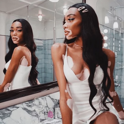 Η Winnie Harlow «ζήλεψε» τα μαλλιά της Kylie Jenner και ορίστε τι χρώμα τα έκανε