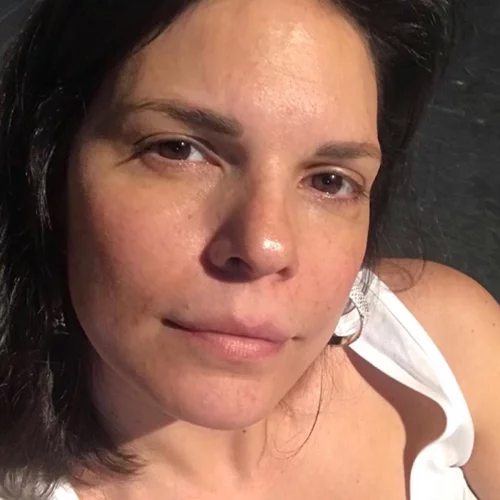 Μαρίνα Ασλάνογλου | Ποζάρει με μαγιό ενάμιση χρόνο μετά τη γέννηση του γιου της (pic)