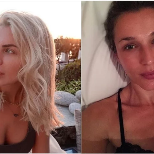 Χωρίς μακιγιάζ | 15 φορές που οι Ελληνίδες celebrities μοιράστηκαν #nomakeup φωτογραφίες
