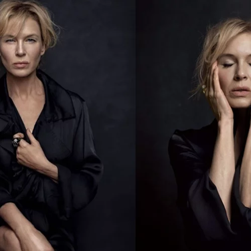 Renée Zellweger | Μίλησε για την δύσκολη περίοδο που αντιμετώπισε και τις πλαστικές επεμβάσεις