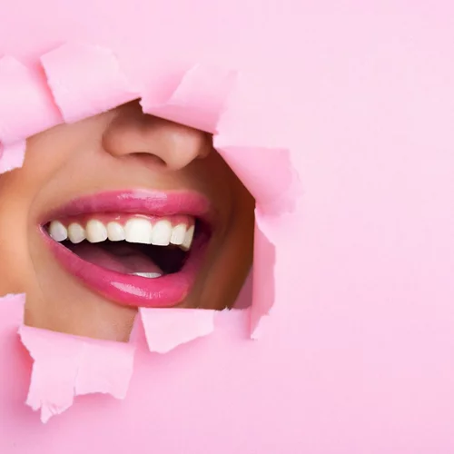 Πώς θα αποκτήσεις κατάλευκα δόντια μόνο σε 30 λεπτά