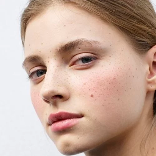 Ξέρετε ποια είναι η σωστή σειρά εφαρμογής των skincare προϊόντων;