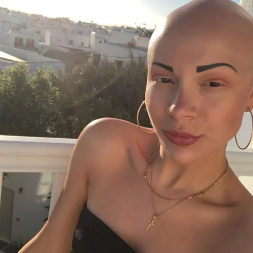 GNTM - Λυδία Κατσανικάκη | Ποζάρει αγνώριστη με καρέ μαλλιά