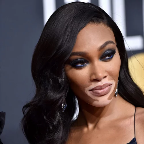 Τέλος τα μακριά μαλλιά για την Winnie Harlow | Δες την με ξανθό à la garçonne
