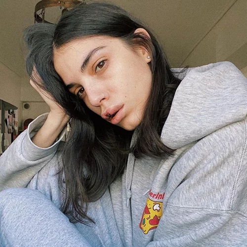 Άννα Μαρία Βέλλη | Το ατύχημα και η φοβερή παραμόρφωση στα χείλη