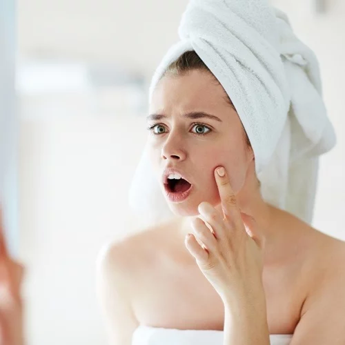 Ο καλύτερος και πιο αποτελεσματικός τρόπος να καλύψεις ακόμα και το πιο έντονο σπυράκι