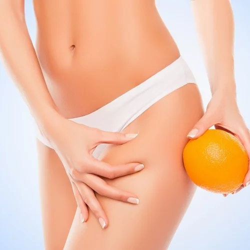 Καταπολέμηση της κυτταρίτιδας: Τα στάδια και η πραγματική αντιμετώπιση αν θέλεις να τη μειώσεις