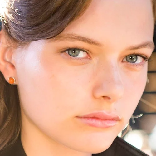 Σπυράκια; Τι να ΜΗΝ κάνεις για να τα ξεφορτωθείς επιτέλους