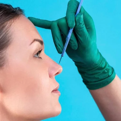 Πλαστική μύτης | 7+1 πράγματα που θέλουμε να γνωρίζουμε