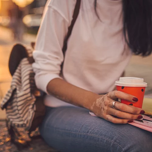 Δέρμα με λεύκη: Πώς να προστατευθώ από τον ήλιο;