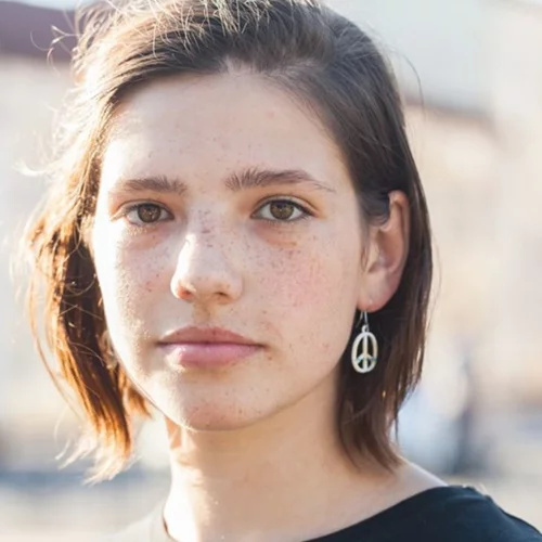 Καταπολέμησε την ακμή με "όπλο" τη διατροφή σου