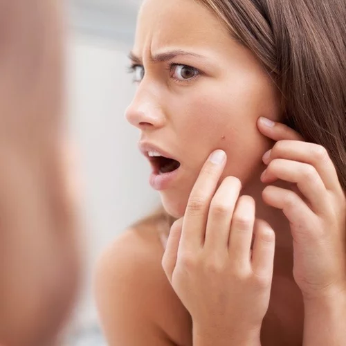 Αλήθεια, εσύ παίρνεις αυτοκόλλητα για τα σπυράκια σου;