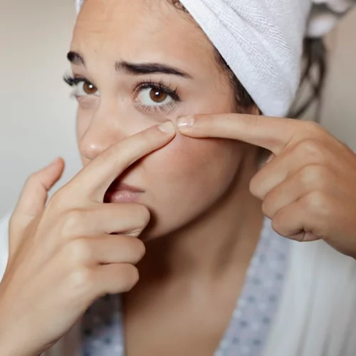 Κυστική ακμή: Ο πιο γρήγορος τρόπος να απαλλαγείς από τα επώδυνα σπυράκια