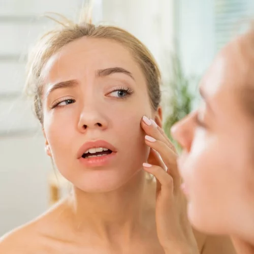 Ροδόχρους νόσος: Πώς θα απαλλαγείς από τα σπυράκια και τις κοκκινίλες;