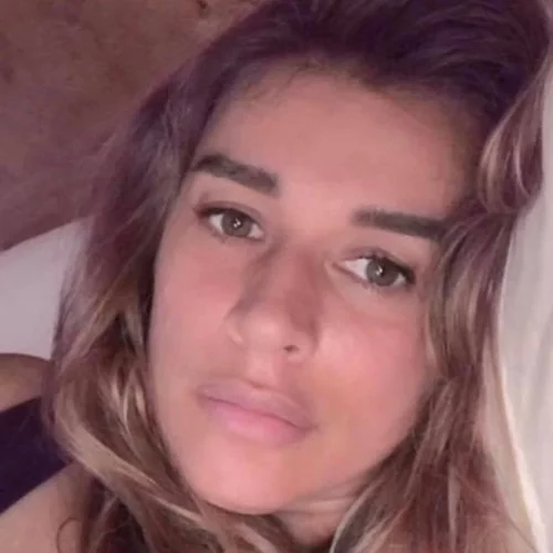 Έρρικα Πρεζεράκου | Η συγκινητική ανάρτησή της 2,5 μήνες μετά τον ακρωτηριασμό