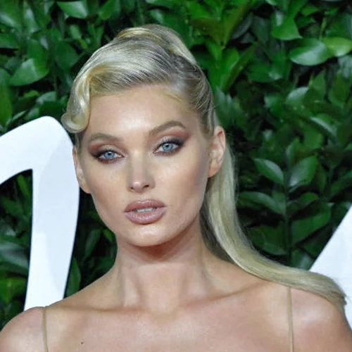 Οι μπούκλες της Elsa Hosk είναι ό, τι πιο ωραίο είδαμε σήμερα