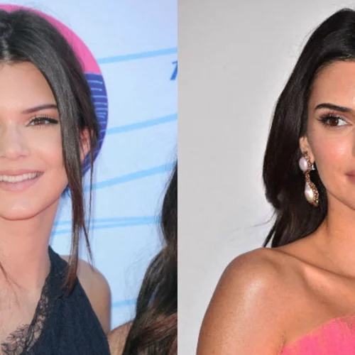 Οι πλαστικές επεμβάσεις των celebrities | Δες το πριν και το μετά