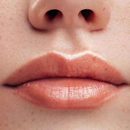 Τι είναι η διορθωτική ρινοπλαστική και άλλες συχνές απορίες για την επέμβαση βρίσκουν απάντηση