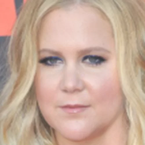 Amy Schumer | Η αποκάλυψη για τον λόγο που έκανε λιποαναρρόφηση