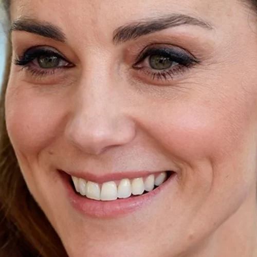 Πώς περιποιούνται οι royals την επιδερμίδα τους;