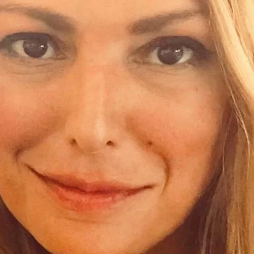 Η food blogger από την Κρήτη δείχνει το πρόσωπό της μετά την κακοποίηση από το σύντροφό της (προσοχή νέες σκληρές εικόνες)