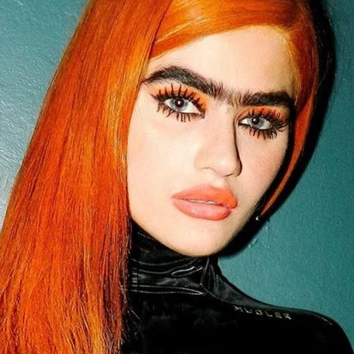 H Σοφία Χατζηπαντελή, πιο ακομπλεξάριστη από ποτέ, δείχνει στους followers της τα αποτελέσματα του botox