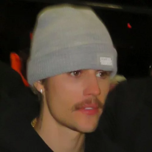 Νεαρή Βρετανίδα που πάσχει από το ίδιο σύνδρομο με τον Justin Bieber αφηγείται πώς ένιωσε βλέποντας το βίντεο του σταρ