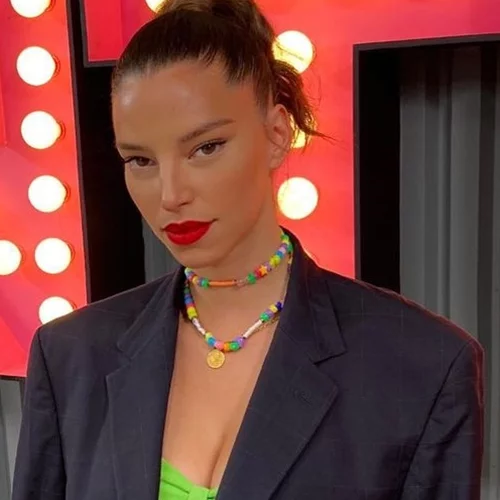 Πρώην παίκτρια του GNTM αποκάλυψε ότι πάσχει από αλωπεκία