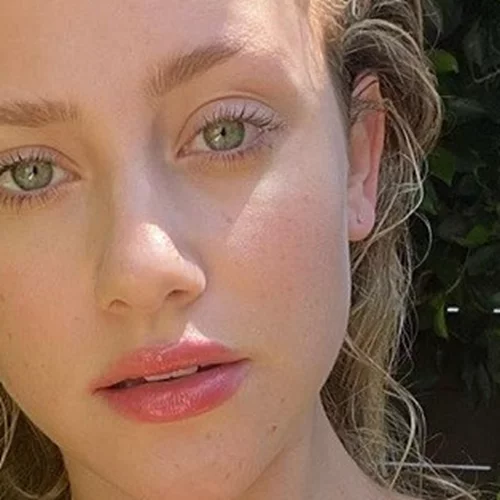 Διεσταλμένοι πόροι; Οι πιο εύκολοι τρόπο να βελτιώσεις την όψη τους