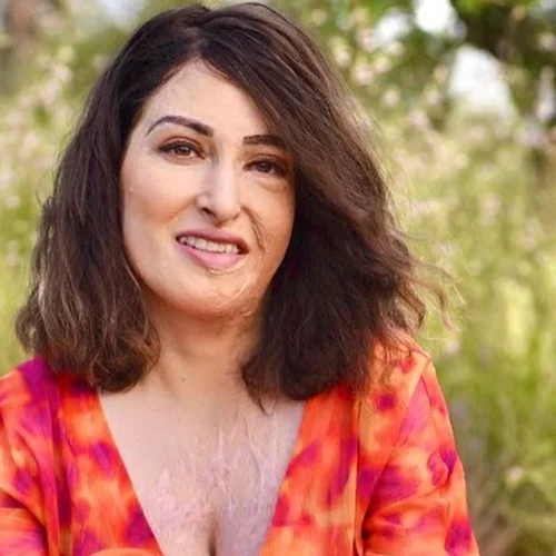 Η Ιωάννα Παλιοσπύρου μιλάει για τα εγκαύματα μετά την επίθεση με το βιτριόλι | "Εκείνη την ημέρα βρισκόμουν σε έκσταση..."