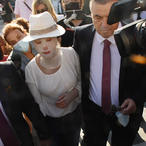 Επίθεση με βιτριόλι: Στο δικαστήριο η Ιωάννα - Συγκλονιστική εμφάνιση με τη μάσκα στο πρόσωπο (εικόνες - βίντεο)
