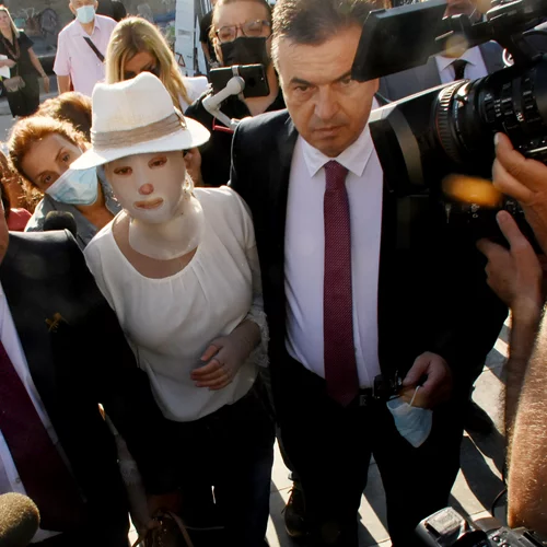 Επίθεση με βιτριόλι | Τι είπε στην Ιωάννα ο δικηγόρος της 36χρονης, Σάκης Κεχαγιόγλου