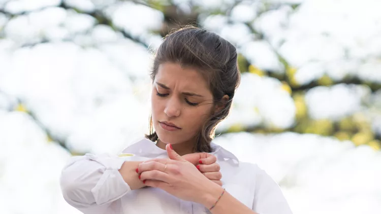 Itch caused by allergy to tree pollen