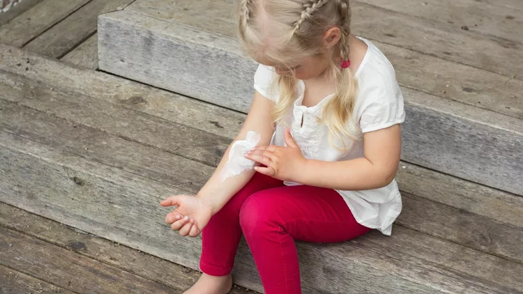 Little girl having skin problem