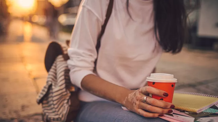 Unrecognizable student girl with vitiligo holding a coffee cup