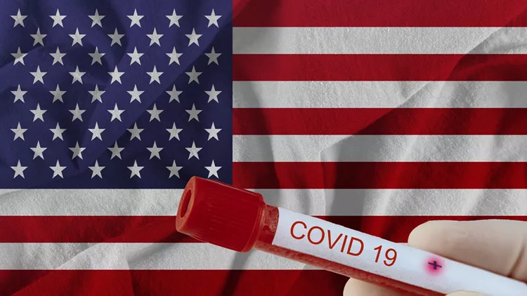 COVID-19 Coronavirus chinese infection of USA with infection blood test in laboratory