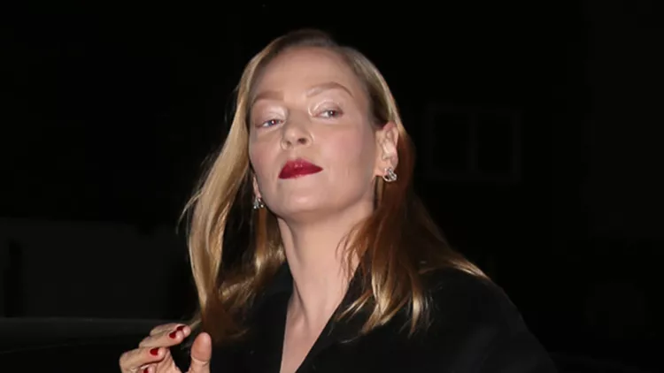 Uma Thurman: Τι συνέβη στο πρόσωπό της;!