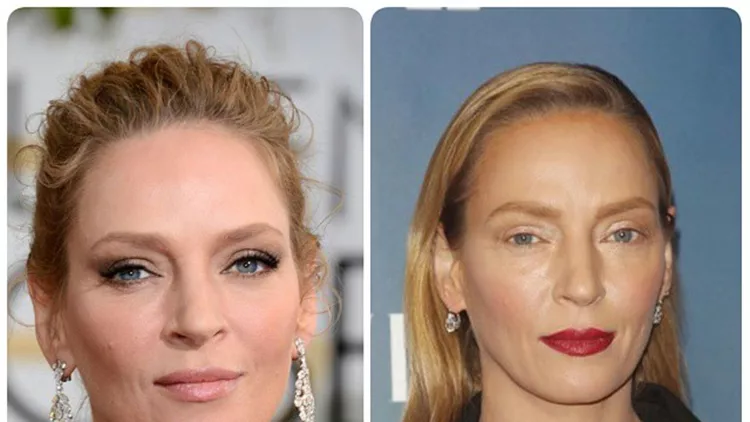 Η Uma Thurman απάντησε μετά το σάλο για το αλλαγμένο πρόσωπο της.