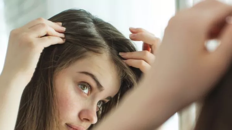Πόσο συχνά να λούζω τα μαλλιά με πιτυρίδα; O μύθος που πρέπει να ξέρεις!