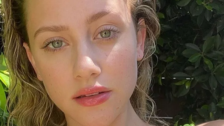 διεσταλμένοι πόροι