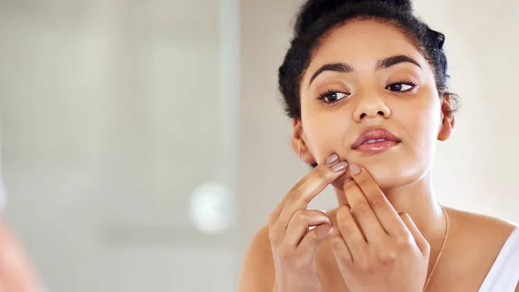 άσπρα μικρά σπυράκια στο πρόσωπο