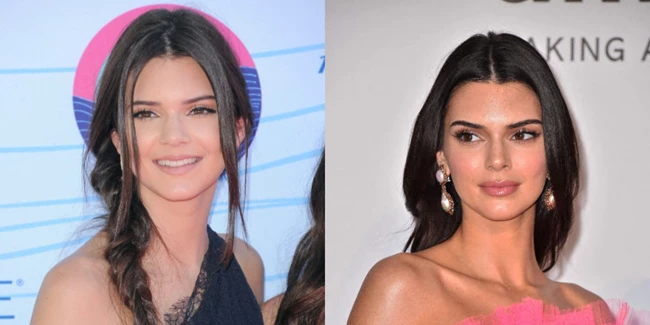 KENDALL JENNER