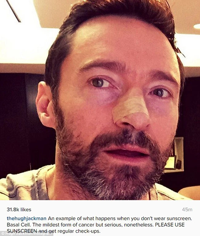 Hugh Jackman: Το συγκινητικό μήνυμα που πέρασε μέσω των social media