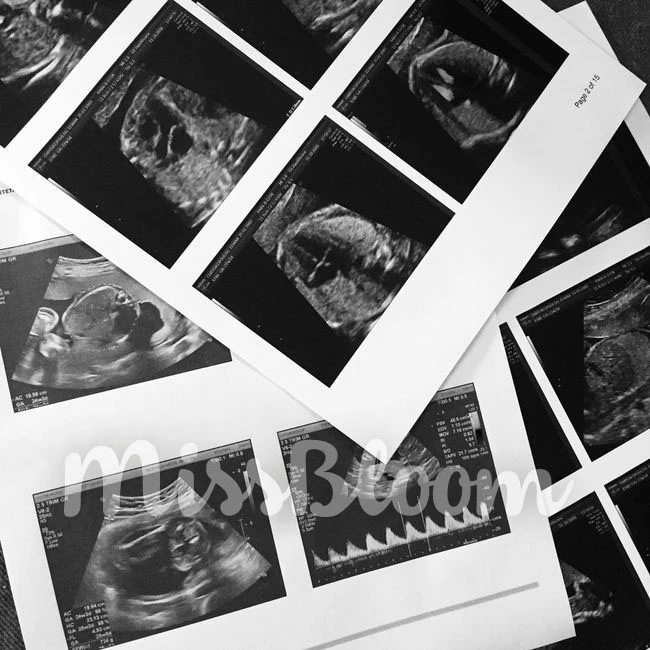 Eliana in Babyland: 10 πράγματα που ΔΕΝ συμβαίνουν στη δεύτερη εγκυμοσύνη
