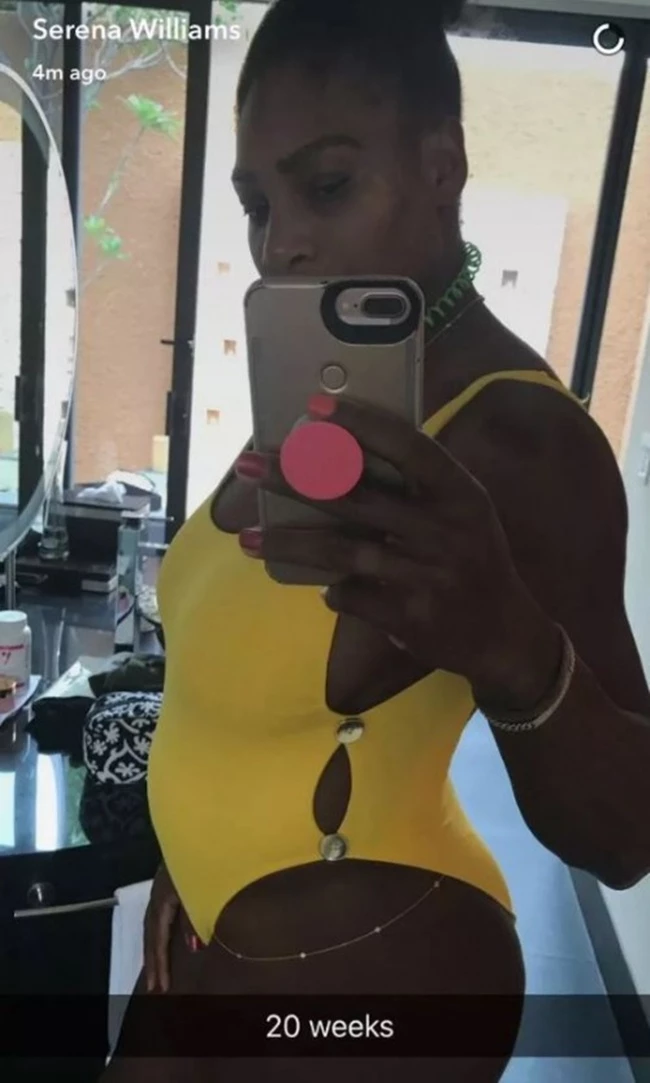 Serena Williams: Αποκάλυψε πως είναι έγκυος μέσω Snapchat
